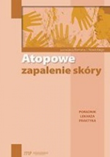 Atopowe zapalenie skóry. Poradnik lekarza praktyka - Roman Nowicki