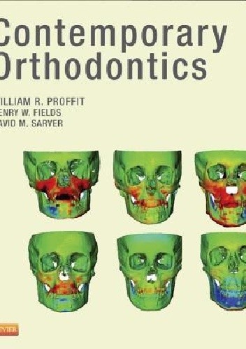 Contemporary Orthodontics - William Proffit