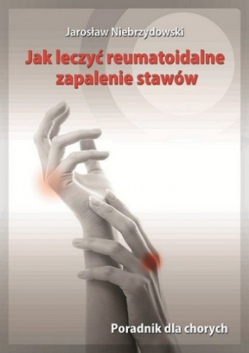 Jak leczyć reumatoidalne zapalenie stawów. Poradnik dla chorych - Jarosław Niebrzydowski
