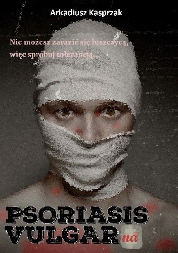 Psoriasis Vulgarna - Arkadiusz Kasprzak